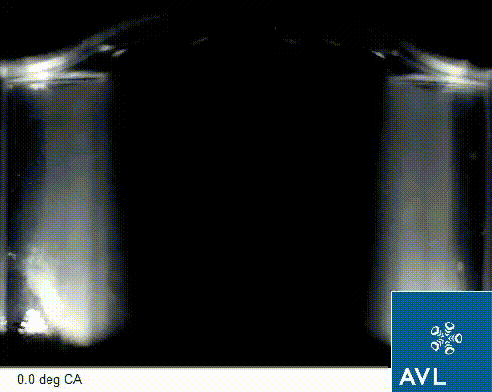 Descrição do GIF 4